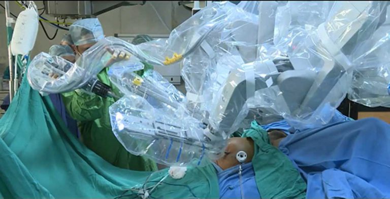 Robotic surgery in Delhi