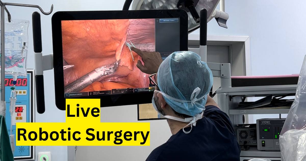 Live robotic surgery