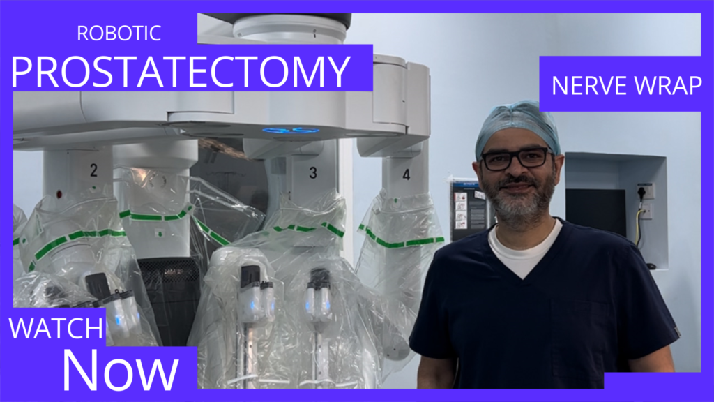 Nerve sparing Robotic prostatectomy with amniotic nerve wrap