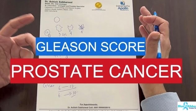 Gleason Score Prostate cancer