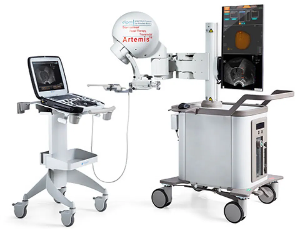 MRI fusion biopsy of the prostate